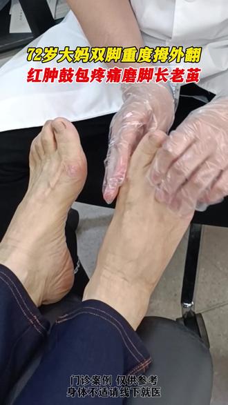 怎么爬对腰椎颈椎最有效 9ac2ff17f75c4b4b96018252262d4ae6_1695286996~tplv-dy-resize-origshort-autoq-75:330.jpeg?biz_tag=pcweb_cover&from=3213915784&s=PackSourceEnum_AWEME_DETAIL&sc=cover&se=false&x-expires=2012151600&x-signature=HeBi736LnzzY0QVVZkU5nYXx8VM%3D