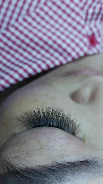 水烧伤怎么处理好得快点 oED90JQERgWQvAnZBgbWetADCxIQSxC2AnAlfA~tplv-dy-resize-origshort-autoq-75:330.jpeg?biz_tag=pcweb_cover&from=3213915784&s=PackSourceEnum_AWEME_DETAIL&sc=cover&se=false&x-expires=2010499200&x-signature=vG7BVW8%2BzeRGqfR4%2BpnB%2FVyCBPI%3D