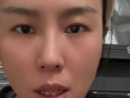 没错领取失业金期间国家会交医保,但是第一个月国家没补缴之前医保停保怎么办?#医保 #失业金 #停保 #失业