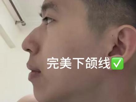 0成本get同款下颌线训练2.0 快来点赞收藏打卡吧!✅ #dou上热门 #嘴凸 #下巴后缩 #下颌线 #反差