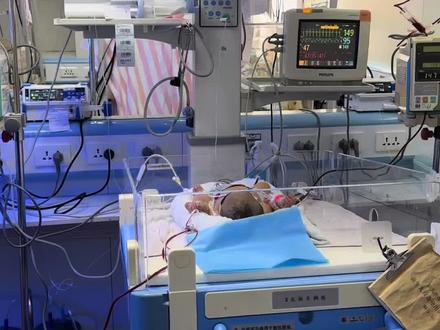 新生儿ABO溶血是一种因母婴血型不合引发的免疫反应性疾病。当母亲是O型血,胎儿为A型或B型血时,母体血液中的抗A或抗B抗体(IgG型)可能通过胎盘进入胎儿体内,破坏胎儿的红细胞,导致溶血。 临床管理的主要目的是避免胆红素脑病的发生。换血疗法(exchange transfusion)是治疗新生儿重症高胆红素血症最迅速有效的方法。早在1925年Hart等首次成功地对新生儿溶血病患儿进行了换血治疗。1951年Diamond等改良了换血方法,用一根聚乙烯管通过脐静脉进行交替抽注血,使换血过程更简单、安全。此后,换血技术得到进一步改进,到20世纪90年代外周动静脉同步换血以及近年来的全自动同步换血的开展,可提高胆红素的换出率,减少感染机会,避免血流动力学的波动所致的不良影响。换血已成为新生儿重症监护中的重要技术之一。换血除了主要用于治疗新生儿溶血病和高胆红素血症外,还可用于治疗新生儿弥散性血管内凝血、严重败血症、药物中毒以及用于去除体内各种毒素等。#新生儿换血#新生儿A B O溶血#敬佑生命