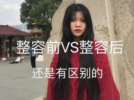 漂亮的五官吸引人,端正的三观留住人,内在外在都要提高 #整容前vs整容后