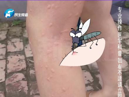 烦!夏季孩子总被蚊虫叮咬,中医分享简单制作驱蚊香囊,“驱蚊还好闻,可随身携带”。