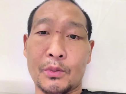 12月26日,高空坠落杂技演员张凯出院并回应网友关注,“爱人去世留下的钱在孩子姥姥姥爷那儿,留给孩子将来考学成家用,我不可能动那里的一毛钱一分钱”#河南dou知道