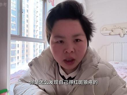 我是如何发现自己得了红斑狼疮的?#系统性红斑狼疮 #红斑狼疮 #红斑狼疮女孩 #红斑狼疮每次复发都是重创