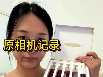 原相机直出|因贝森白番茄饮实测
今天第13天,个人测试,仅供参考#因贝森白番茄饮
#黄黑皮逆袭
#内服美白
#真实美白记录
#原相机无滤镜