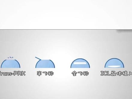 #近视手术 什么全飞秒近视手术,看完你就明白了#近视#全飞秒近视手术