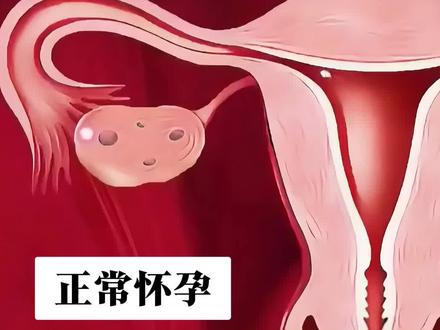 包含女人为什么会宫外怀孕的词条 包含女人为什么会宫外怀孕的词条