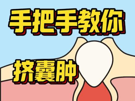 皮肤科医生手把手教你挤囊肿 #皮脂腺 #囊肿#皮脂腺囊肿 #挤痘痘