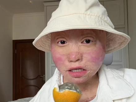 西双版纳的热带水果#热情果 #新鲜采摘