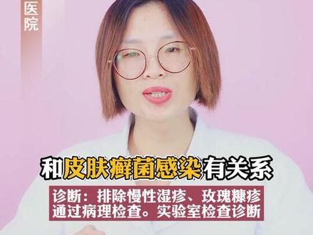 难看的#体癣 ,试试这个方法治疗。#科普 #皮肤