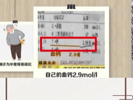 血钙和骨钙,不是一回事儿~#补钙