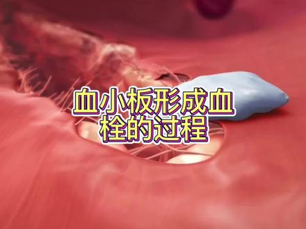 血小板是怎么形成血栓的#医学动画#凝血#微观世界