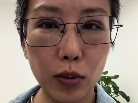 #植发#胡须植发 😐,得那种浓密的络腮胡