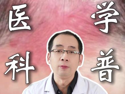 这可不是湿疹,而是鹤吻痕! #抖出健康知识宝藏#儿科医生#湿疹 #鹤吻痕 #家长必读