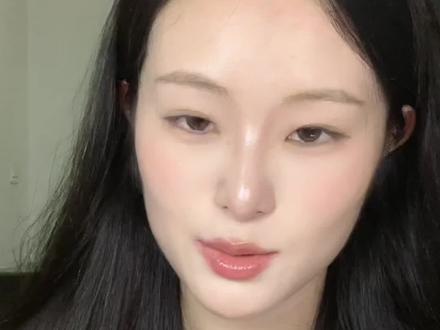 高度近视十几年改善眼凸的好方法
#高度近视 #眼凸 #干货