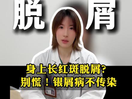 身上长红斑脱屑?别慌!银屑病不传染,这样控制超有效#银屑病 #脱屑 #医学科普 #抖出健康知识宝藏 #我的年度健康盘点