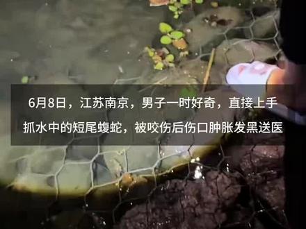 男子好奇伸手抓路边水池的短尾蝮蛇,被咬伤后伤口肿胀发黑
