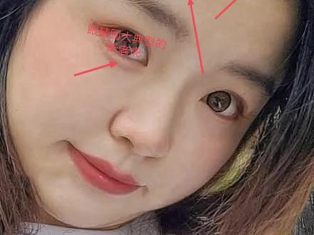 今日客户案例简单分享几句给大家额头带美人尖,而且发亲如额,额窄如浅,六亲缘分浅,难得长辈助力学业受限……