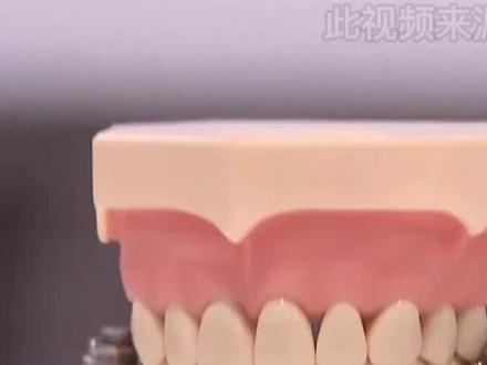 你会为了减肥给牙齿加把锁吗?#口腔科普 #涨知识 #减肥