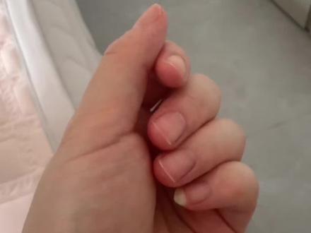 预防老年痴呆症手势舞 #一起举个爪子