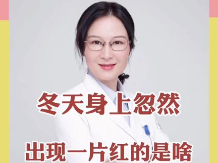 #医学科普 #抖音 #红斑 冬天用取暖要预防火激红斑