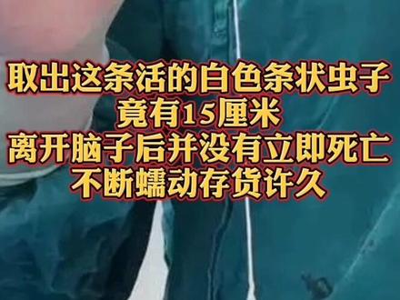 吓人!23岁女生突发头疼,原因竟是它!