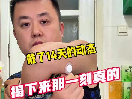 动态血糖仪佩戴教程 动态怎么佩戴能更准确#动态血糖仪 #欧态动态血糖仪 #血糖监测 #欧态 #糖友