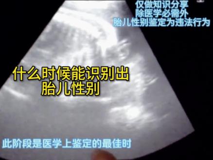 什么时候能识别出胎儿性别#胎儿 #性别