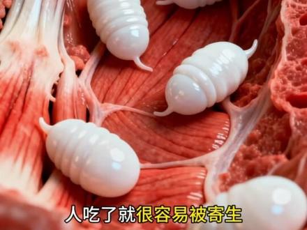 如果你不想眼睛和脑子都长满寄生虫,这几种食物千万别吃#科普 #寄生虫