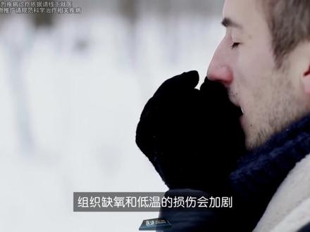 搓雪取暖=肌肉冻裂?! #抖出健康知识宝藏 #健康乘风计划 #冻伤 #冻伤怎么办 #冻伤应急方法