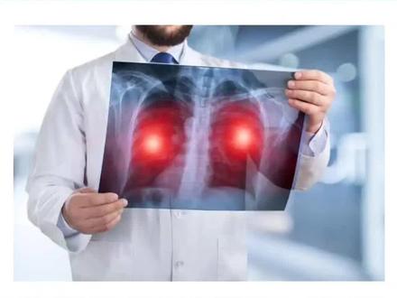 肺癌是被“气”出来的
这四种“气”要远离