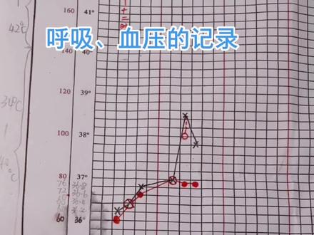 体温单上呼吸、血压的绘制