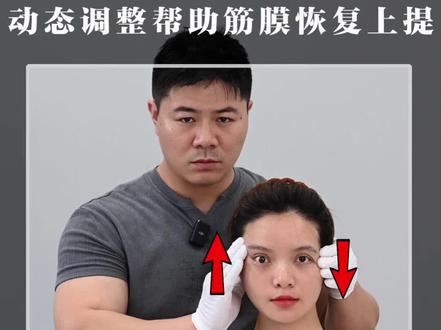 眼尾下垂,眼睛下垮,可以这样调整改善