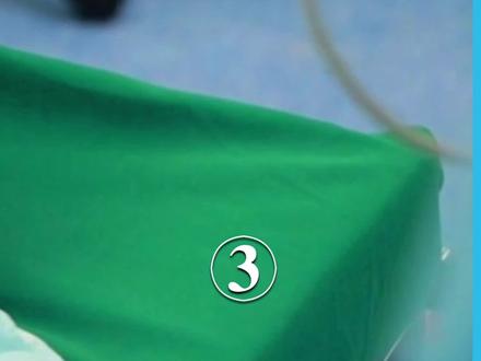 医生给5岁女孩做开颅手术,过程太惊险#纪实 #纪录片解说 #手术室日常 #医生 #健康 #颅咽管瘤