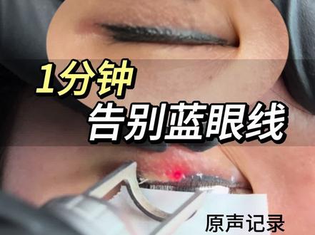 洗掉年代感 ##洗眼线 #成都洗眼线 #成都 #洗眼线几次可以洗干净 #洗眼线疼吗