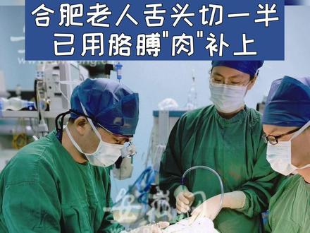 误把舌癌当溃疡 合肥老人舌头切一半 已用胳膊"肉"补上