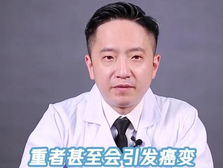 #问答c计划 紫外线灯对人体的伤害