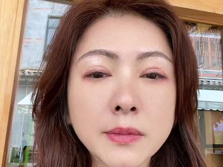 呼吸之灸给我带来的改变!真实感受🙏