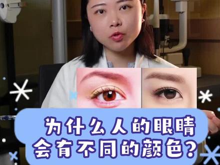 为什么人的眼睛会有不同的颜色?#医学科普 #眼睛 #眼睛颜色 @抖音小助手 @DOU+小助手 @DOU+上热门