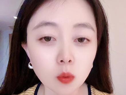 广西为什么那么多地中海贫血?#地中海贫血