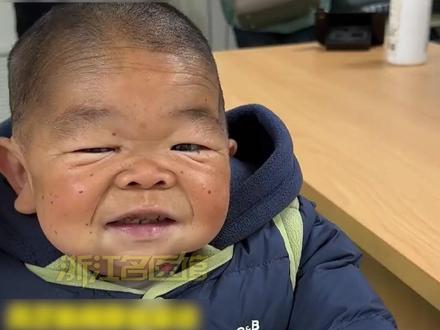 湖南25岁小伙身高仅60多厘米,湖南省儿童医院提供免费基因筛查,医生:初诊为罕见早老症。