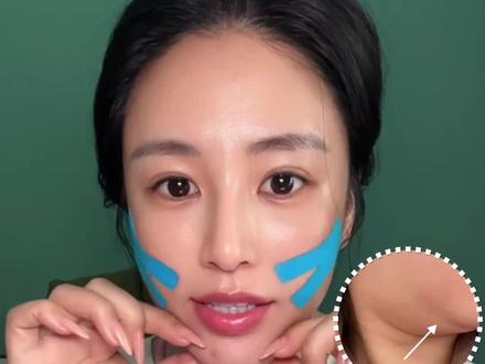 又双下巴了怎么办#医美 #抗衰 #变美