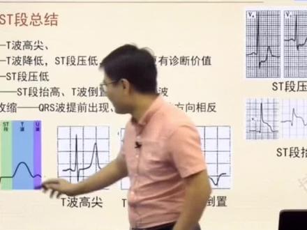 心电图ST段压低怎么看?#护士懂护士 #博傲关永俊 #护士 #护考 #2021护考 #21年护考 #初级护师