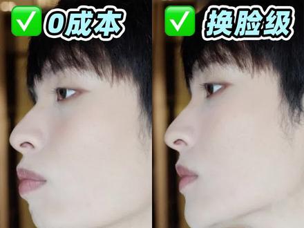 假性嘴凸滚出拆那!3招拯救凸嘴、下巴后缩!!#凸嘴 #变美 #口呼吸