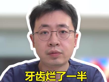 牙齿快烂了!到底是拔牙好还是补牙好呢?#蛀牙 #口腔科刘博闻 @抖音小助手