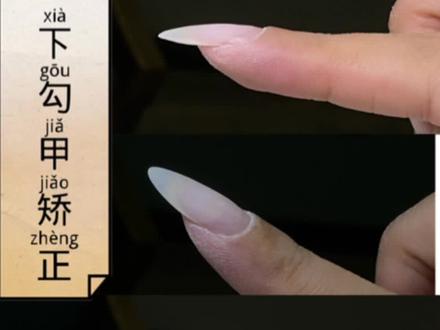 下勾甲矫正~#高级美甲教程 #美甲教程 #美甲课程 #美甲教学 #下勾甲矫正