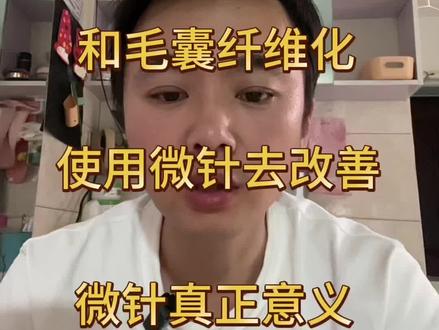 关于头皮的硬度和毛囊纤维化和使用微针 #真实生活分享计划 #脱发 #脂溢性皮炎 #头皮屑 #毛囊炎