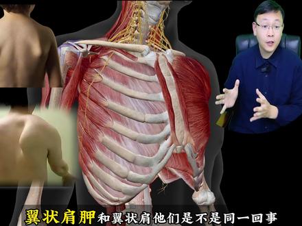小孩子肩胛骨翘起,警惕不是瘦,可能是翼状肩胛。 带您了解翼状肩与翼状肩胛的联系与区别
#翼状肩胛 #翼状肩 #康复训练 #抖出健康知识宝藏 #我的年度健康盘点