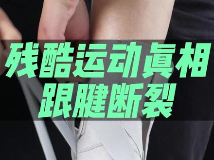 残酷运动真相之“跟腱断裂”,说到跟腱断裂会让你想到哪位球星#运动防护 #保护踝关节 #百斯锐护踝 @DOU+小助手 @抖音小助手